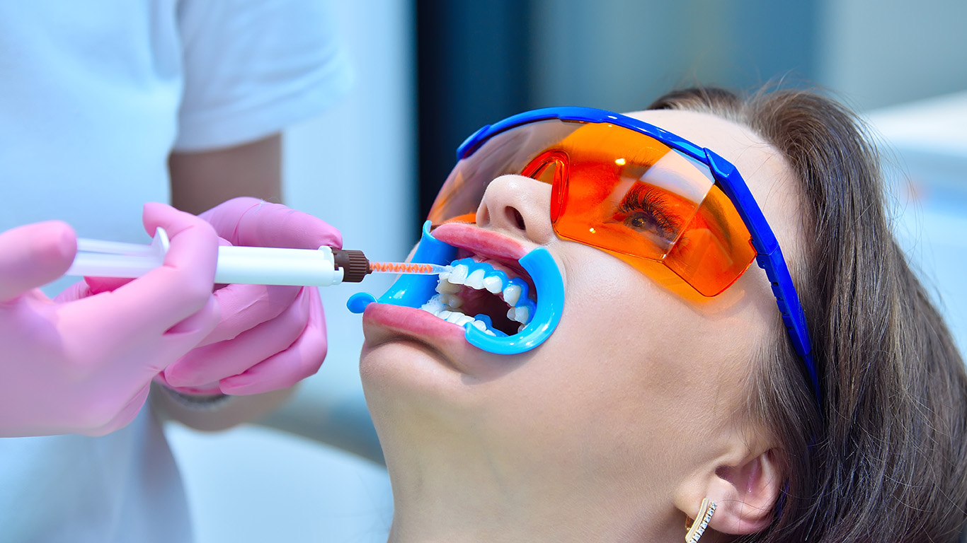 blanchiment-des-dents-Sion-VSDental-dentiste-esthetique-dentaire